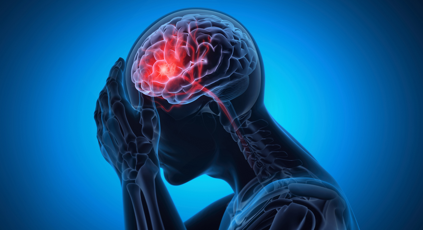 Man with a headache -  Brain Stroke -  X ray 3D Illustration with blue background