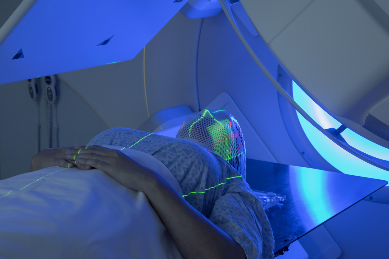 Woman Receiving Radiation Therapy Treatments for Head & Neck Cancer with Head Cast