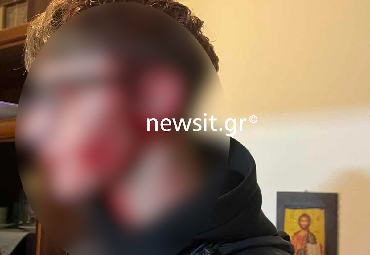 Θεσσαλονίκη: «Τους προκάλεσε», λέει ο πατέρας ενός εκ των δραστών του άγριου ξυλοδαρμού του 16χρονου