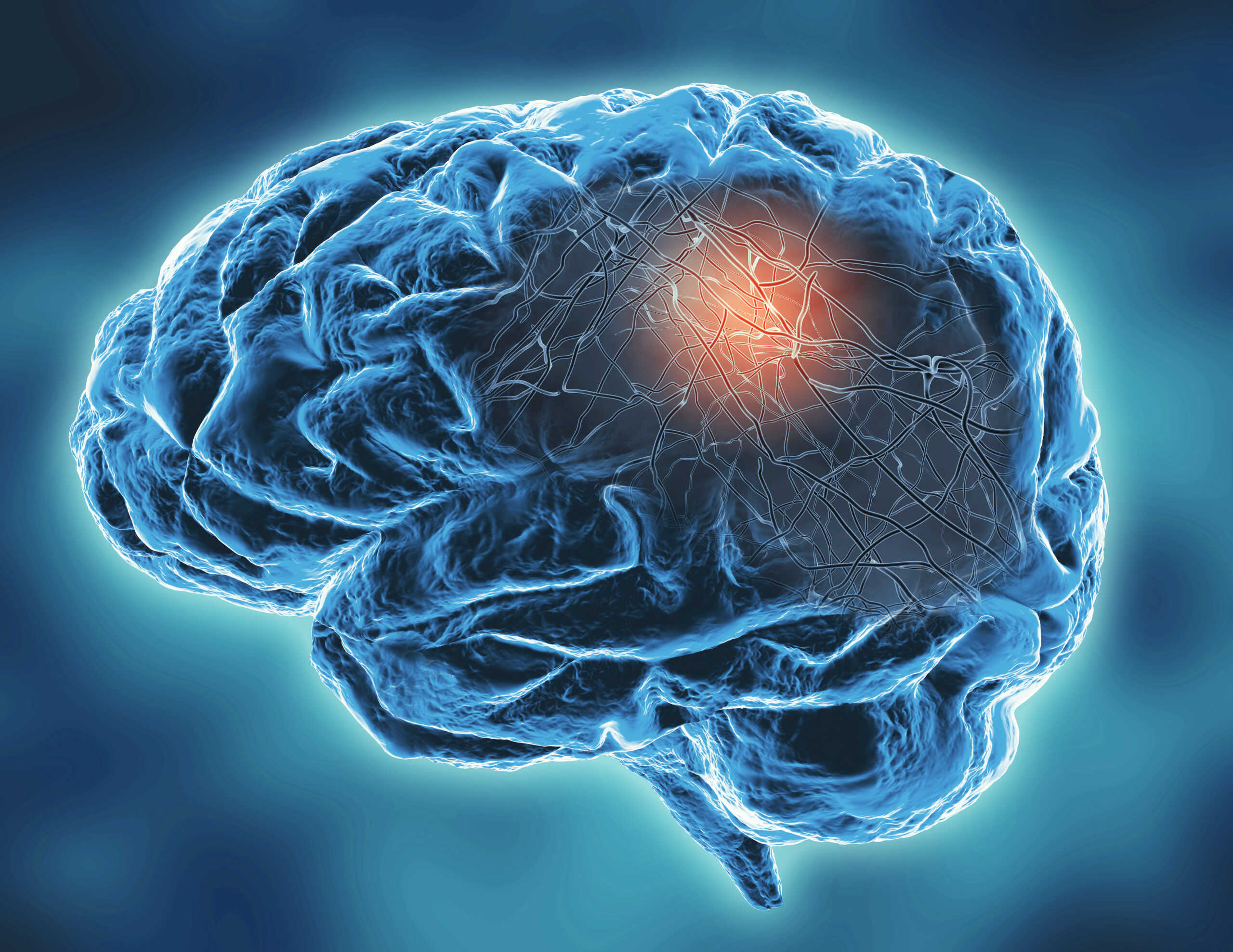 Neurodegenerative disease concept illustration. Alzheimer's, Parkinson's disease concept 3d illustration.