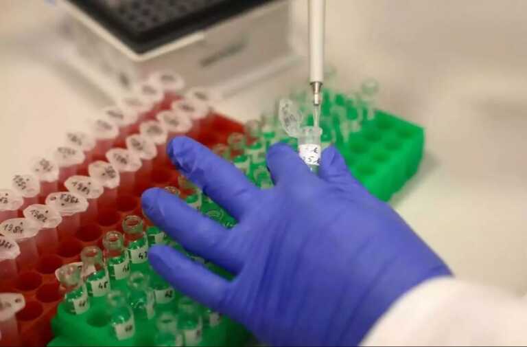 Οι καθυστερημένες διαγνώσεις και η απουσία PrEP εμπόδια για τη μείωση των κρουσμάτων HIV στην Ελλάδα