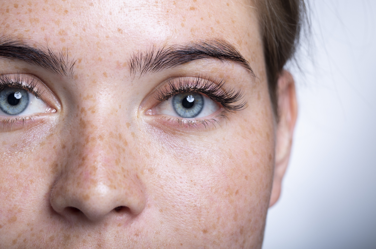 Cute skin girl with freckles, blue eyes. Looks at the camera. Portrait, close-up. On a white background.
