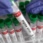 FILE PHOTO: A test tube labelled "Mpox virus positive" is held in this illustration taken August 20, 2024. REUTERS