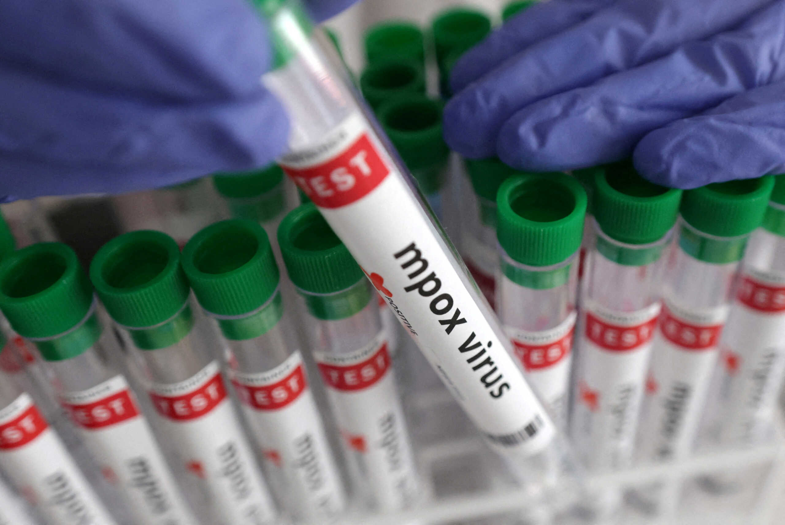FILE PHOTO: A test tube labelled "Mpox virus positive" is held in this illustration taken August 20, 2024. REUTERS