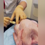 Ο Αθανάσιος Εξαδάκτυλος ετοιμάζει τη γαλοπούλα στο χειρουργικό τραπέζι