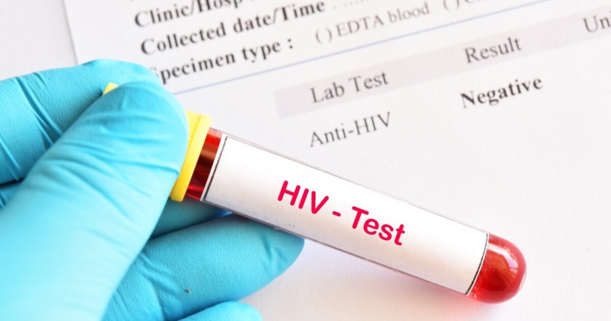 HIV prevention drug is ‘achievement of the year’ for 2024