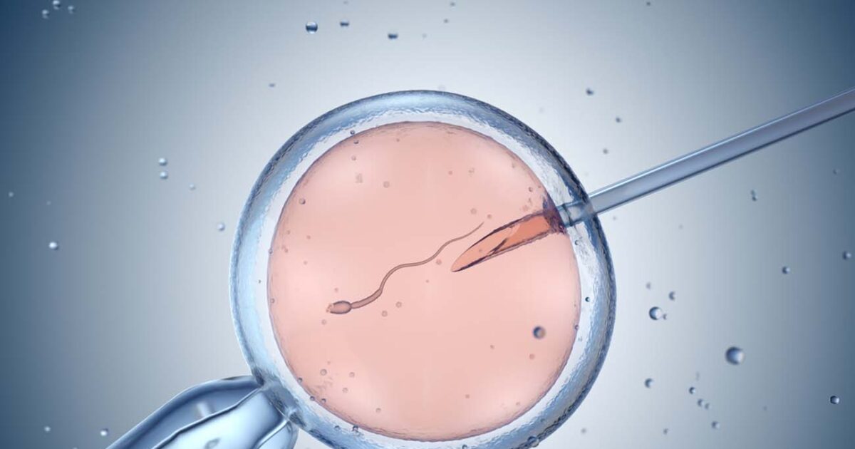 IVF -free fertilization