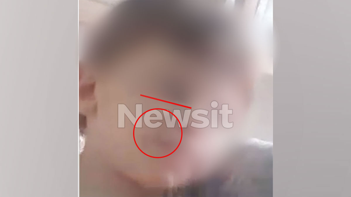 Ηράκλειο: Σημάδια από το κεφάλι έως τα δάχτυλα του ποδιού στο κορμάκι του 3χρονου Άγγελου από τους βάναυσους ξυλοδαρμούς – Τι είδε ο ιατροδικαστής