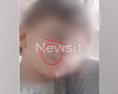 Ηράκλειο: Σημάδια από το κεφάλι έως τα δάχτυλα του ποδιού στο κορμάκι του 3χρονου Άγγελου από τους βάναυσους ξυλοδαρμούς – Τι είδε ο ιατροδικαστής