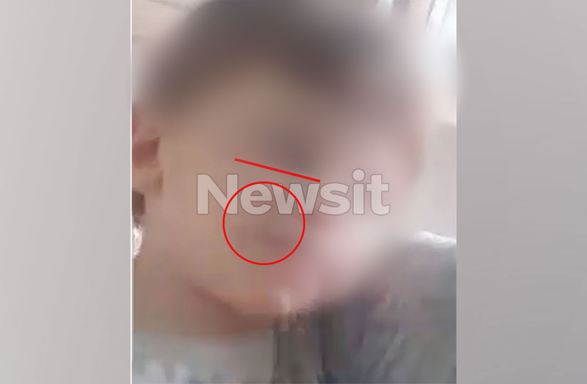 Ηράκλειο: Σημάδια από το κεφάλι έως τα δάχτυλα του ποδιού στο κορμάκι του 3χρονου Άγγελου από τους βάναυσους ξυλοδαρμούς – Τι είδε ο ιατροδικαστής