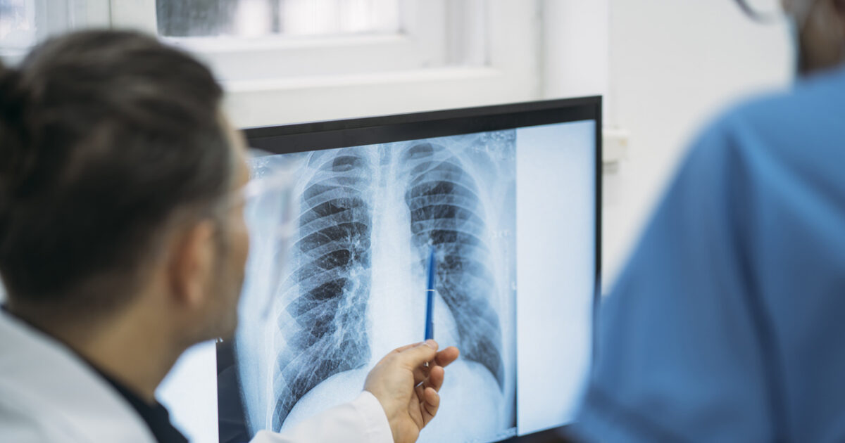 Defeating lung cancer
