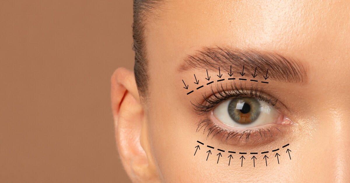 How the blepharoplasty refreshes the face