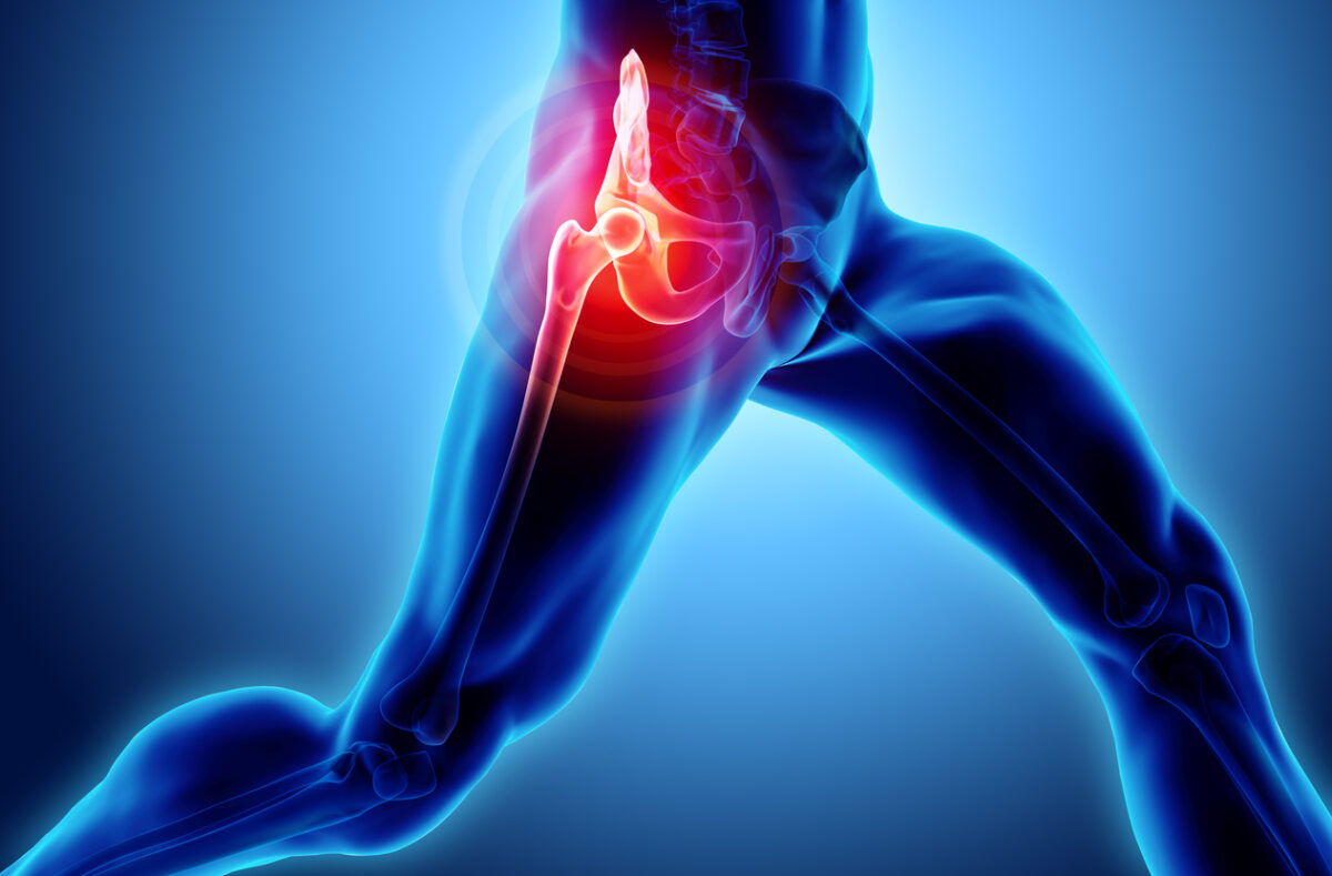 3D illustration, hip painful skeleton x-ray, medical concept
