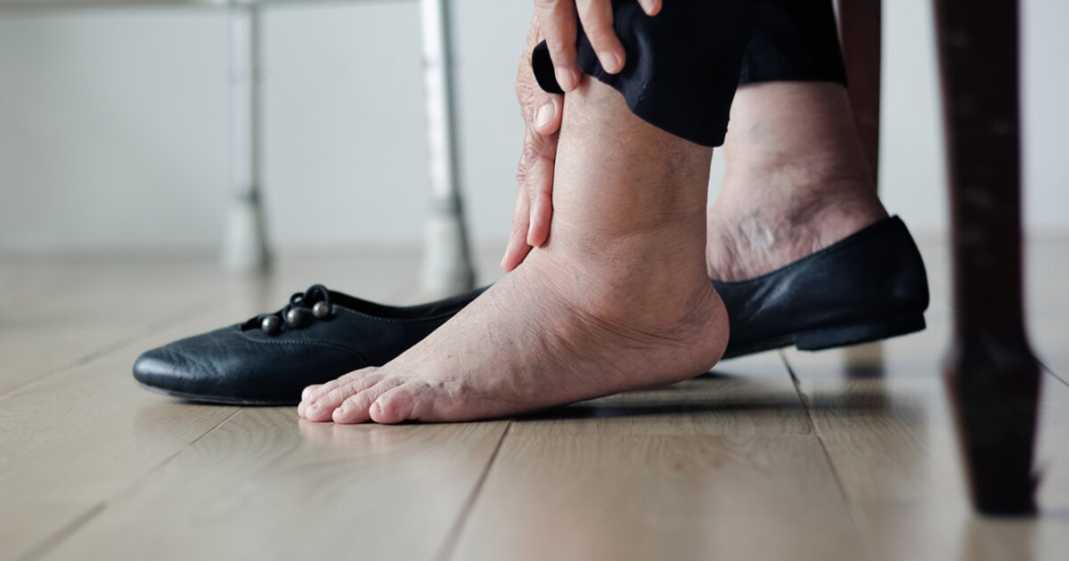 Physical solutions to get rid of fungi on the legs