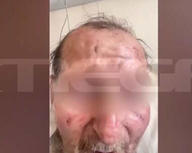 Ο 60χρονος που προκάλεσε το τροχαίο δυστύχημα στον Λαγκαδά Θεσσαλονίκης