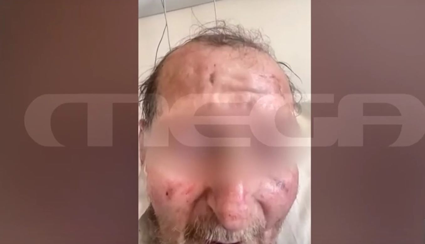Ο 60χρονος που προκάλεσε το τροχαίο δυστύχημα στον Λαγκαδά Θεσσαλονίκης