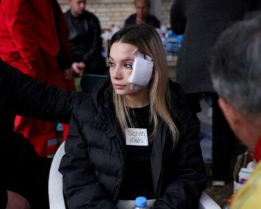 Εγκαυματίας από τη φωτιά στη Βόρεια Μακεδονία