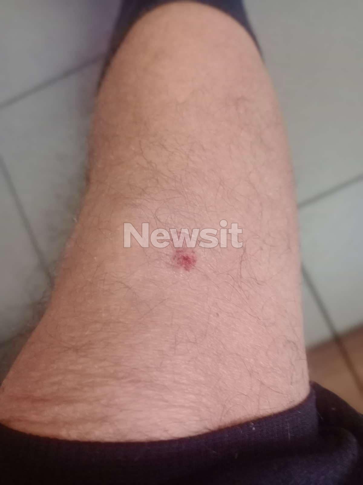 Ένα πόδι