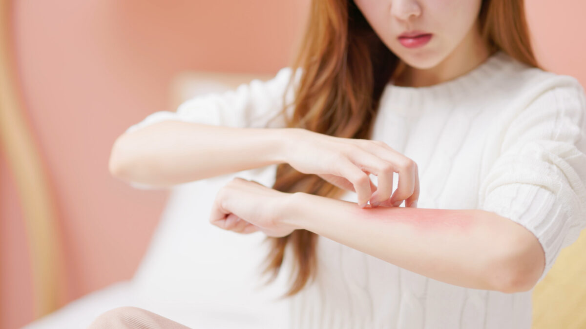 Closeup view asian female arm dry itchy problems in autumn and winter