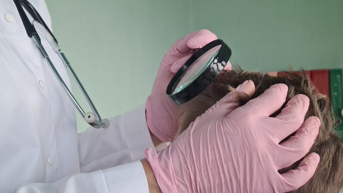 Trichologist holds magnifying glass checking hair of children and teenagers. Medic rips off guy head and hair