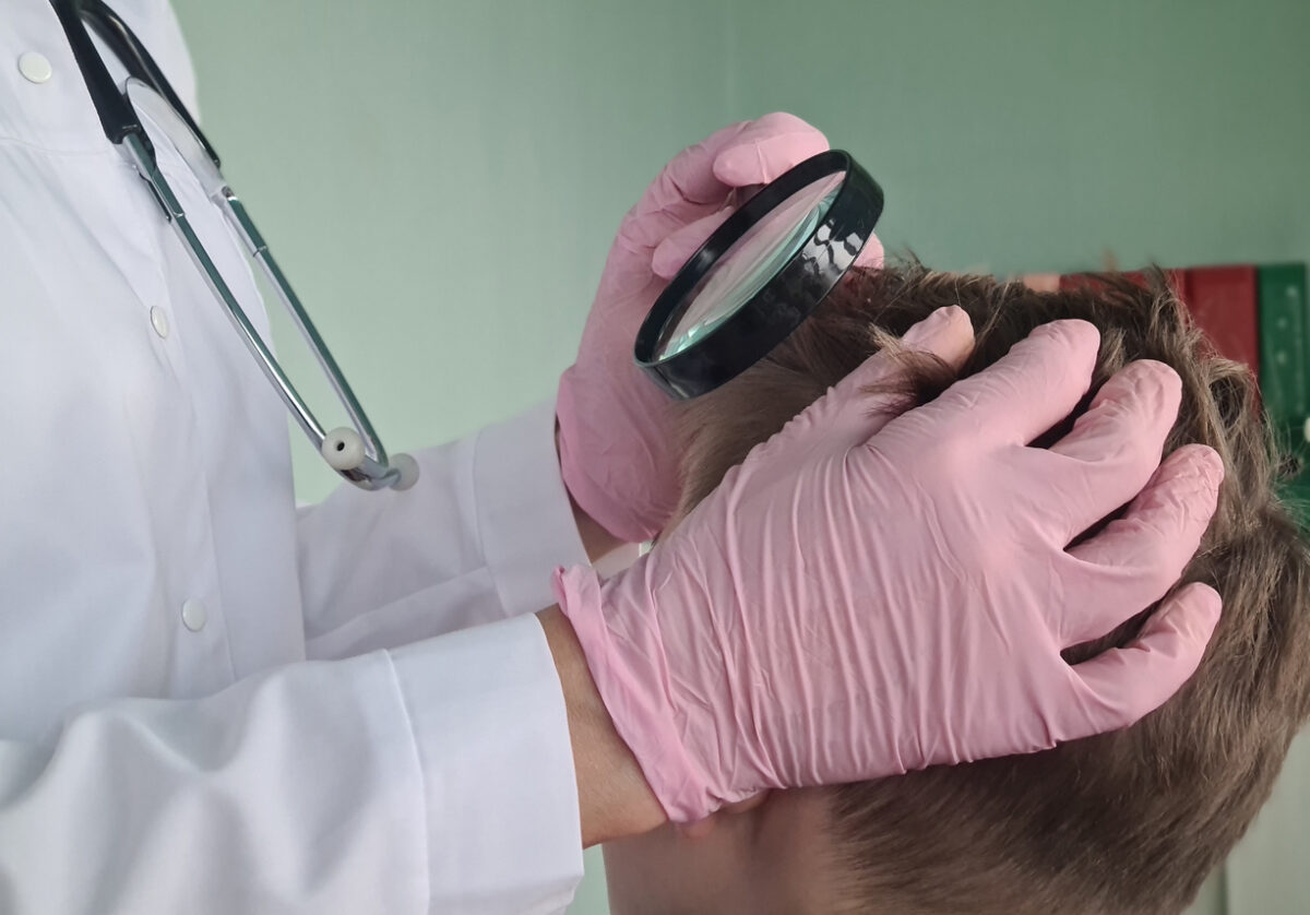 Trichologist holds magnifying glass checking hair of children and teenagers. Medic rips off guy head and hair