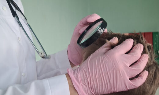 Trichologist holds magnifying glass checking hair of children and teenagers. Medic rips off guy head and hair