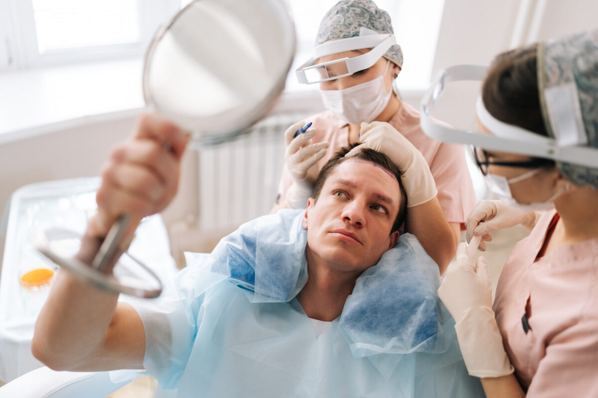 Closeup portrait of male patient with hair loss problem talking with female trichologist marking who with pencil new hairline on head before hair transplantation surgery. Concept of baldness treatment