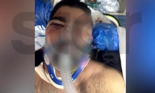 Αστυνομική βία καταγγέλλει πατέρας 20χρονου στην Κηφισιά