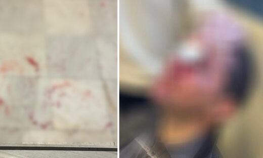 Νομική Σχολή Αθηνών: Κουκουλοφόροι εισέβαλαν σε εκδήλωση και χτύπησαν φοιτητές – Στο νοσοκομείο ένας άνθρωπος