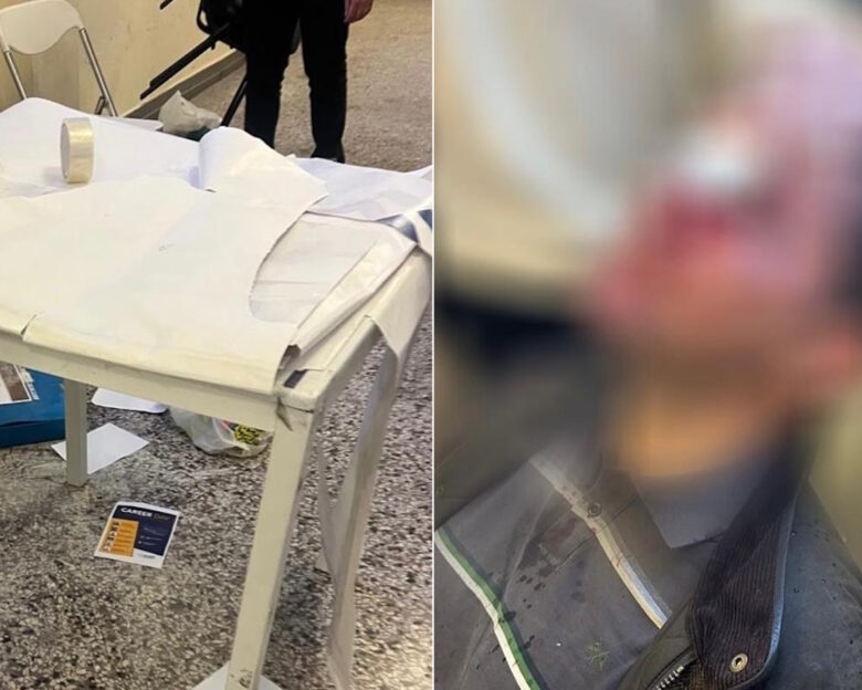Νομική Σχολή: Καθηγητής περιγράφει την άγρια επίθεση των κουκουλοφόρων στον διδακτορικό φοιτητή – «Τον χτυπούσαν με κράνη και γκλοπ – Ήταν γεμάτος αίματα»