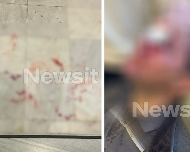 Νομική Σχολή Αθηνών: Κουκουλοφόροι εισέβαλαν σε εκδήλωση και χτύπησαν φοιτητές – Στο νοσοκομείο ένας άνθρωπος