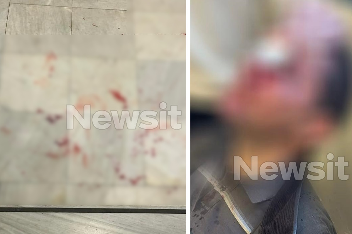 Νομική Σχολή Αθηνών: Κουκουλοφόροι εισέβαλαν σε εκδήλωση και χτύπησαν φοιτητές – Στο νοσοκομείο ένας άνθρωπος