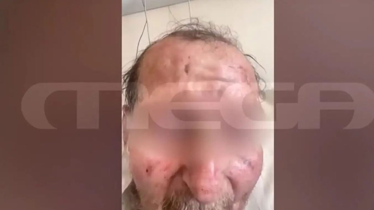Ο 60χρονος που προκάλεσε το τροχαίο με θύμα την 50χρονη