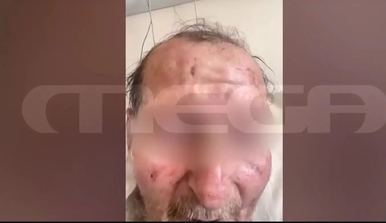 Ο 60χρονος που προκάλεσε το τροχαίο με θύμα την 50χρονη