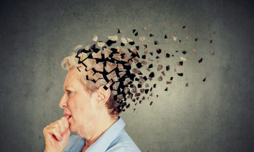 Memory loss due to dementia. Senior woman losing parts of head feeling confused as symbol of decreased mind function.