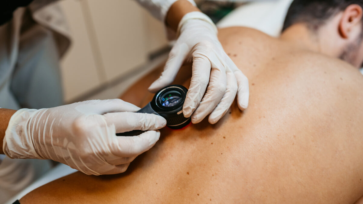Female doctor examining patients birthmarks for skin cancer in a medical clinic.