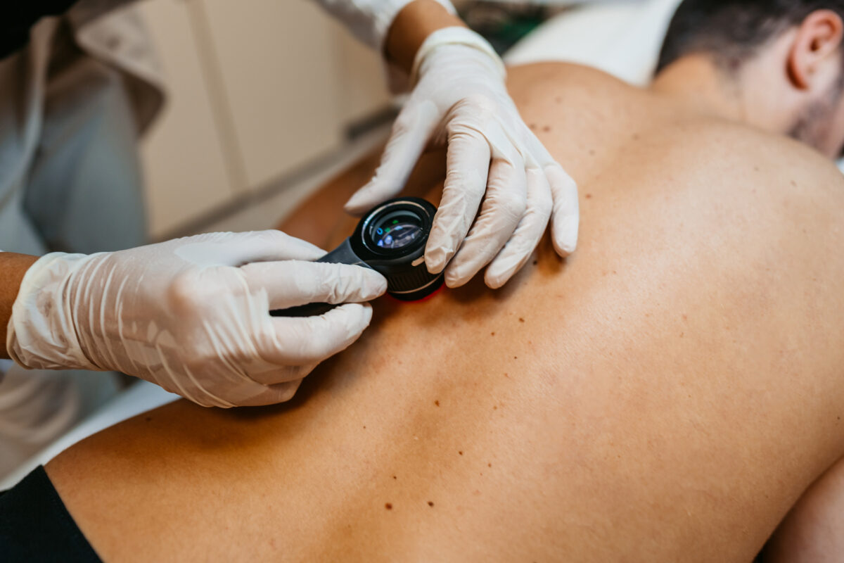 Female doctor examining patients birthmarks for skin cancer in a medical clinic.