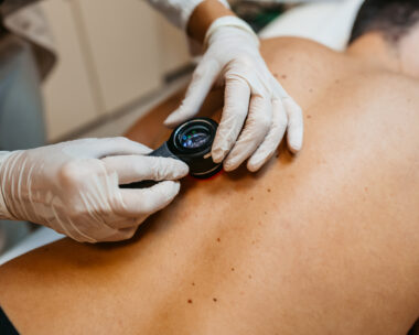 Female doctor examining patients birthmarks for skin cancer in a medical clinic.