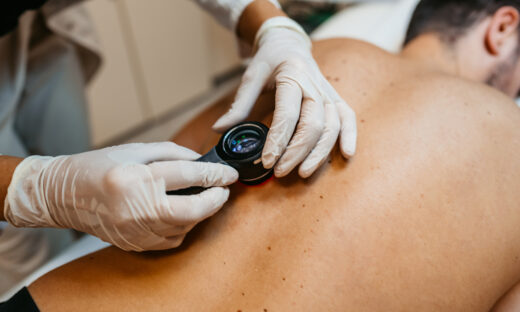 Female doctor examining patients birthmarks for skin cancer in a medical clinic.
