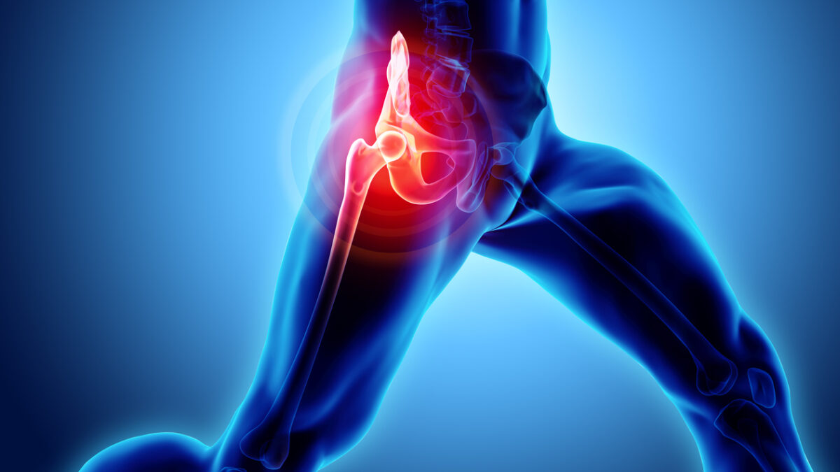 3D illustration, hip painful skeleton x-ray, medical concept.