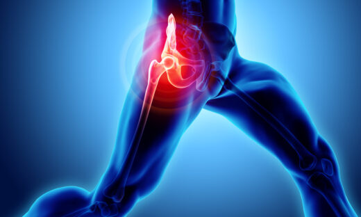3D illustration, hip painful skeleton x-ray, medical concept.
