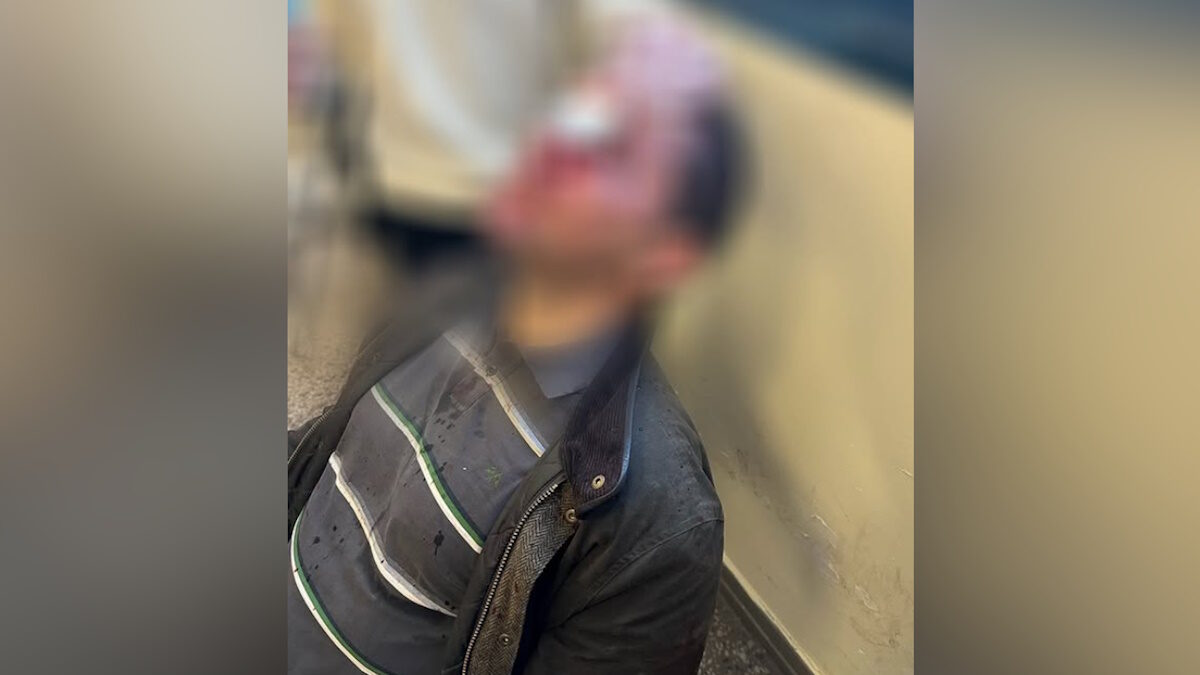 O χτυπημένος διδακτορικός φοιτητής της Νομικής Σχολής Αθήνας