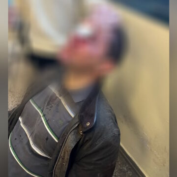 O χτυπημένος διδακτορικός φοιτητής της Νομικής Σχολής Αθήνας