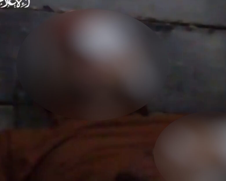 Η Χαμάς δημοσίευσε νέο βίντεο με Ισραηλινό όμηρο: Γεμάτος αίματα εκλιπαρεί να αφεθούν ελεύθεροι όλοι οι κρατούμενοι
