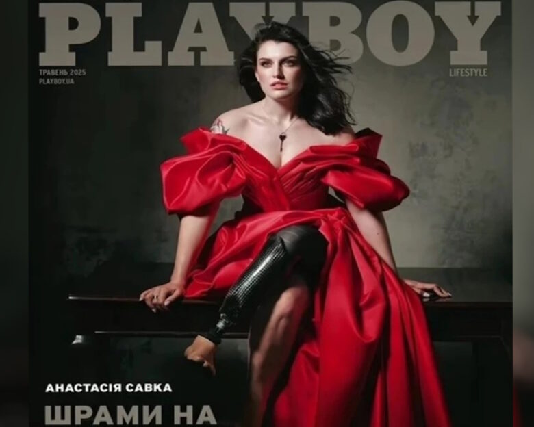 Το Playboy της Ουκρανίας κάνει αφιέρωμα στις γυναίκες που ακρωτηριάστηκαν ή τραυματίστηκαν από τον πόλεμο: «Είμαστε ζωντανές»