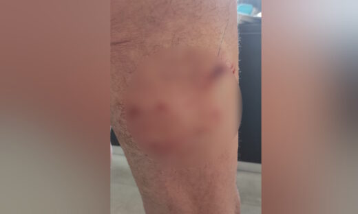 Από την επίθεση στον 71χρονο