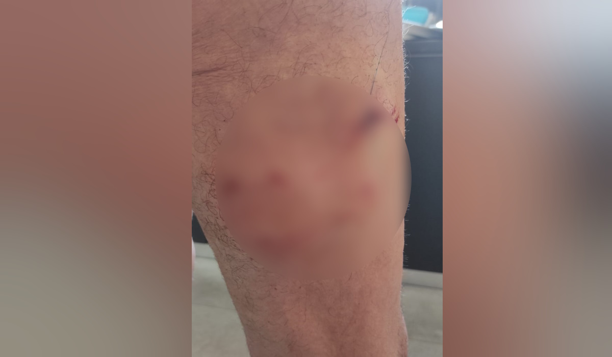 Από την επίθεση στον 71χρονο
