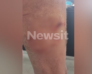 Από την επίθεση στον 71χρονο