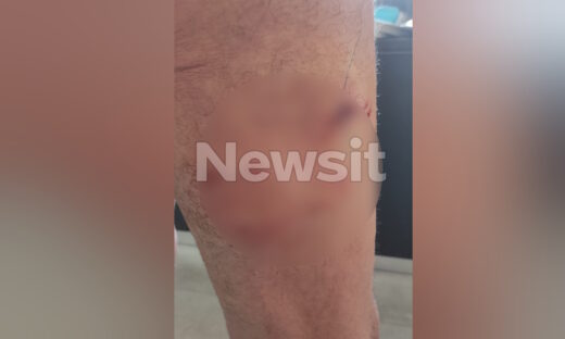 Από την επίθεση στον 71χρονο