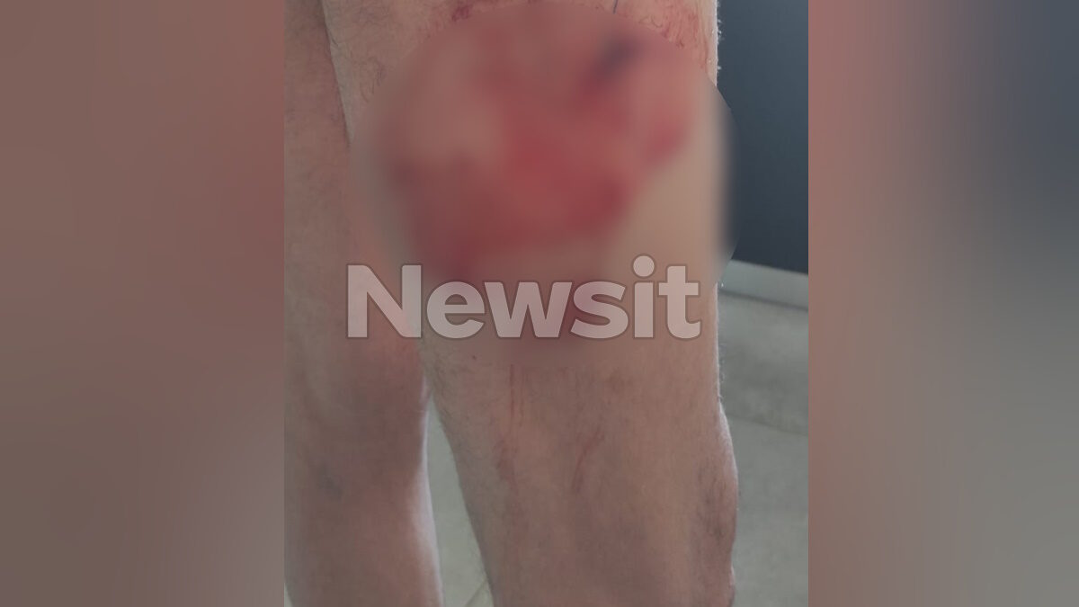Από την επίθεση στον 71χρονο